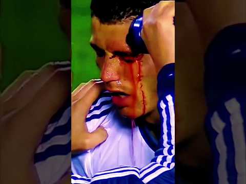 Cristiano Ronaldo Revenge 😱😱😱 Eye Bleeding |Revenge| #shorts