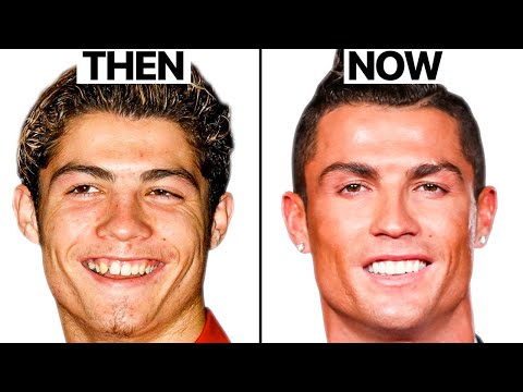 Cristiano Ronaldo NEW FACE | Plastic Surgery Analysis